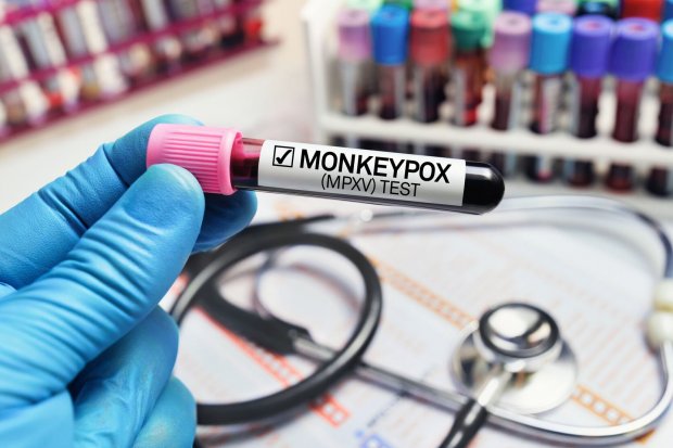 First Monkeypox Case in Indonesia: What Now? | D-Insights