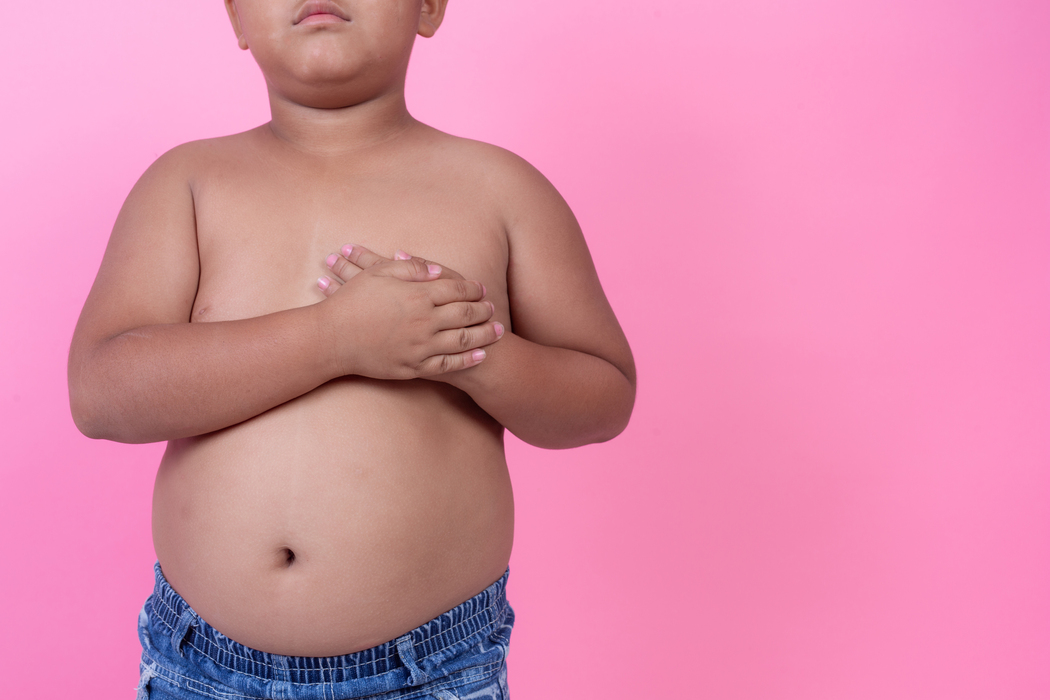 Ilustrasi Obesitas pada Anak