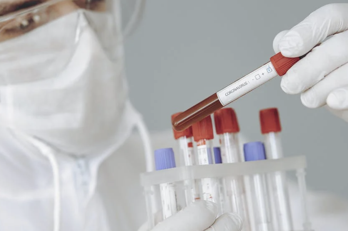 Tips Lolos Medical Check Up Perusahaan