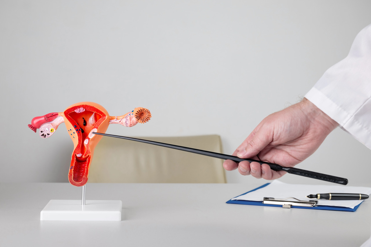 Alasan Kenapa Haid Tidak Teratur