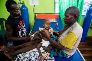 Campak dan Gizi Buruk Anak Asmat