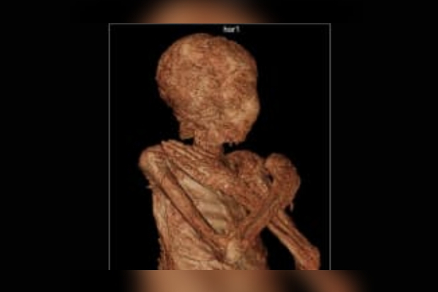 Hasil pemindaian mumi Mesir yang hamil