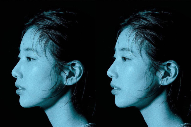 Suzy