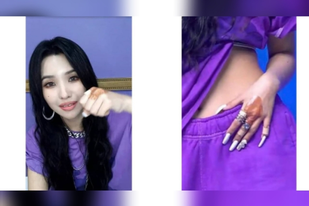 Luka Soyeon (G)-IDLE setelah meninju kamera MCountdown
