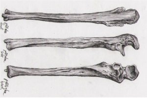 Ilustrasi tulang hasta