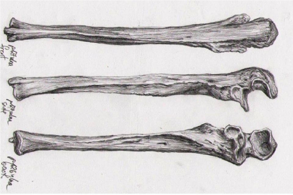 Ilustrasi, tulang hasta. Fungsi tulang hasta paling utamanya salah satunya yaitu memungkinkan tangan bergerak bebas dan meningkatkan rotasinya.