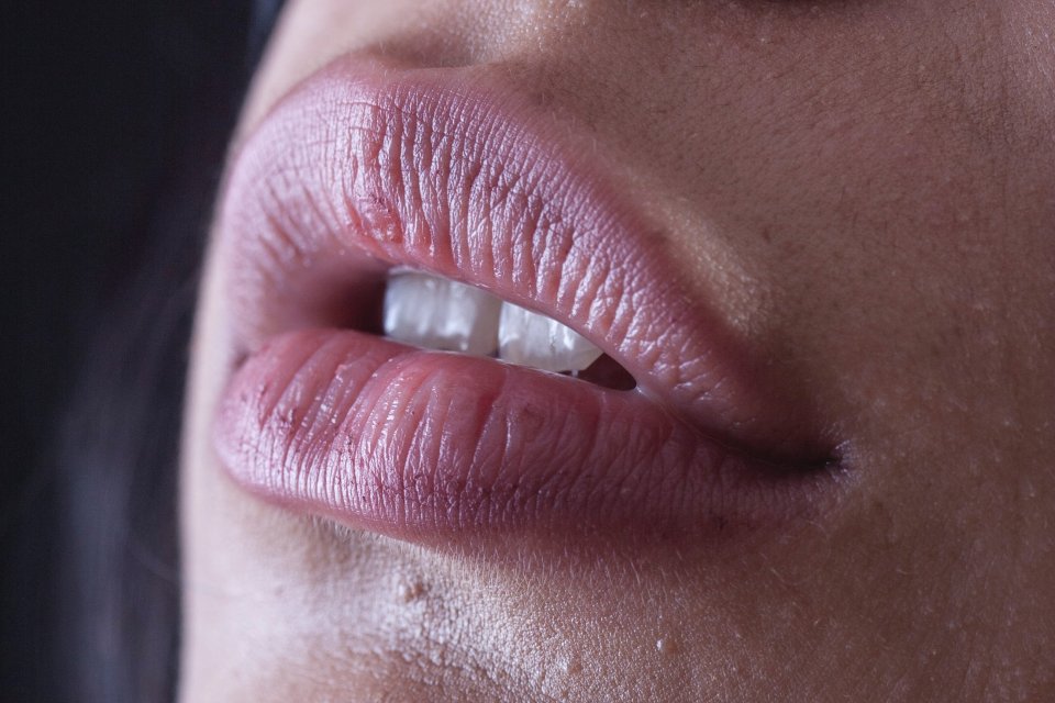 cara mengatasi bibir hitam secara alami