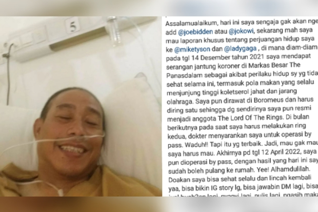 Pidi Baiq operasi setelah kena serangan jantung koroner