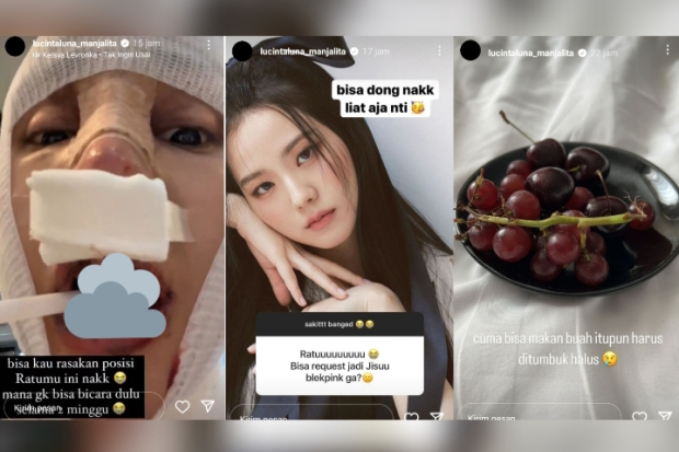Kondisi Lucinta Luna Usai Operasi