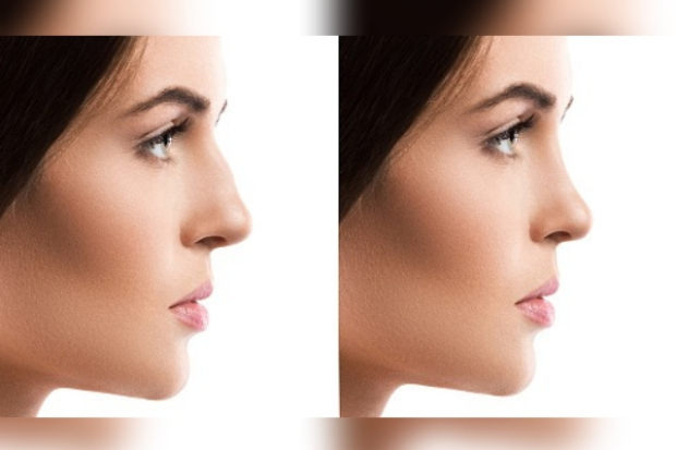 Ilustrasi hidung mancung