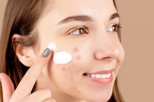 rekomendasi skincare untuk kulit berminyak