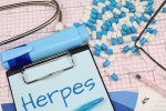 Ilustrasi, penjelasan penyakit herpes