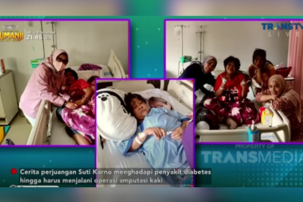 Suti Karno diabetes hingga kaki harus diamputasi