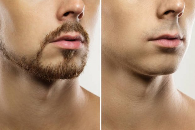 Cara menumbuhkan kumis tipis