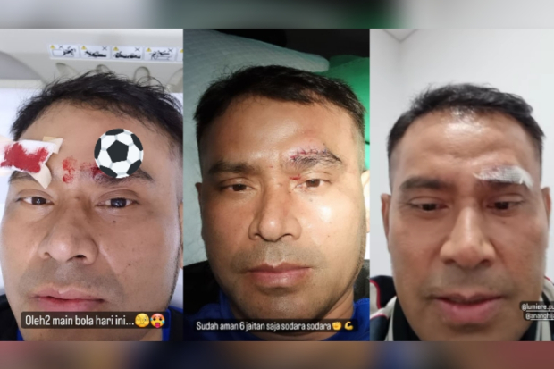 Judika dilarikan ke rumah sakit usai main bola