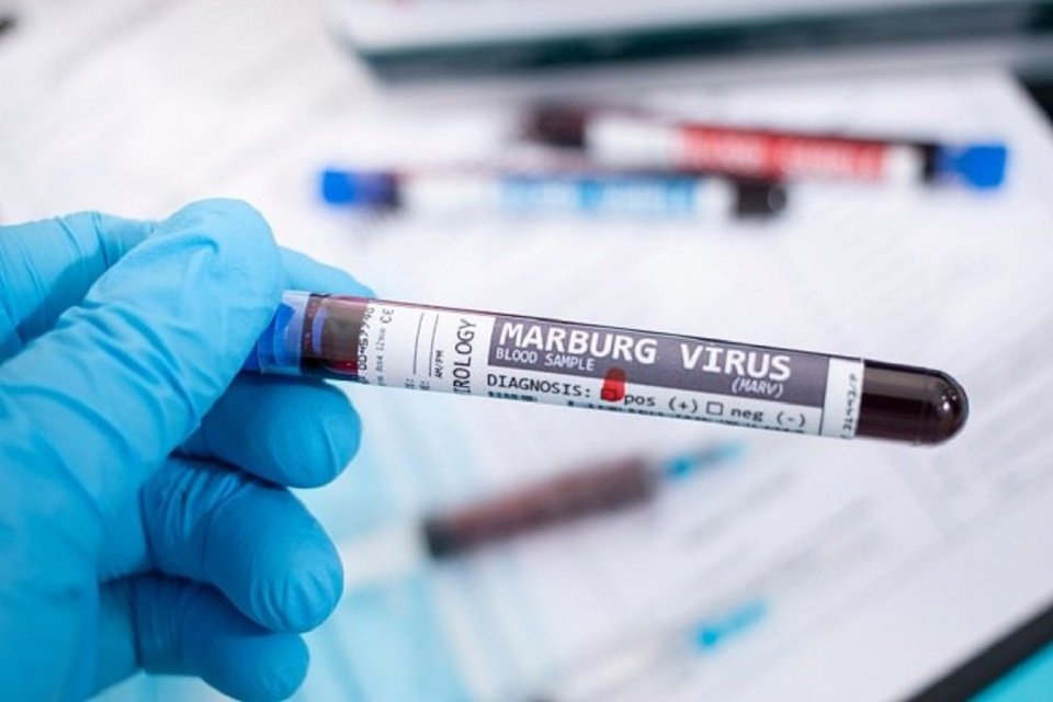 Virus Marburg, who