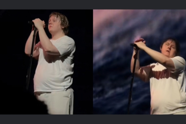 Sindrom Tourette Lewis Capaldi Kambuh Saat Konser du Jerman