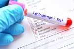 Gejala Leptospirosis