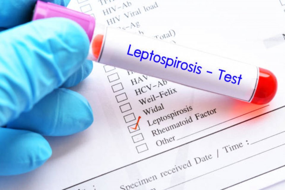 Gejala Leptospirosis