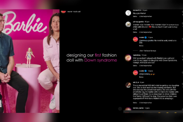 Barbie down syndrome