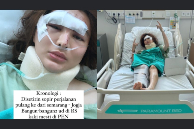 Kronologi Angela Lee Alami Kecelakaan