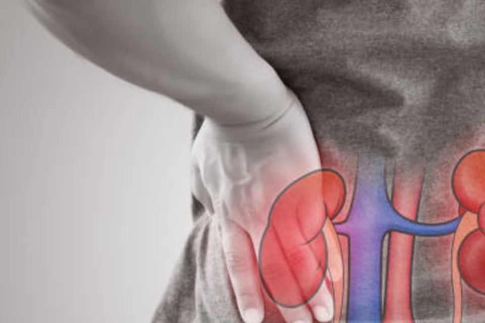 Cara Mencegah Penyakit Ginjal