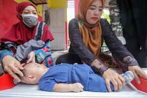 Angka prevalensi stunting di Jawa Timur menurun