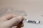 Virus HMPV