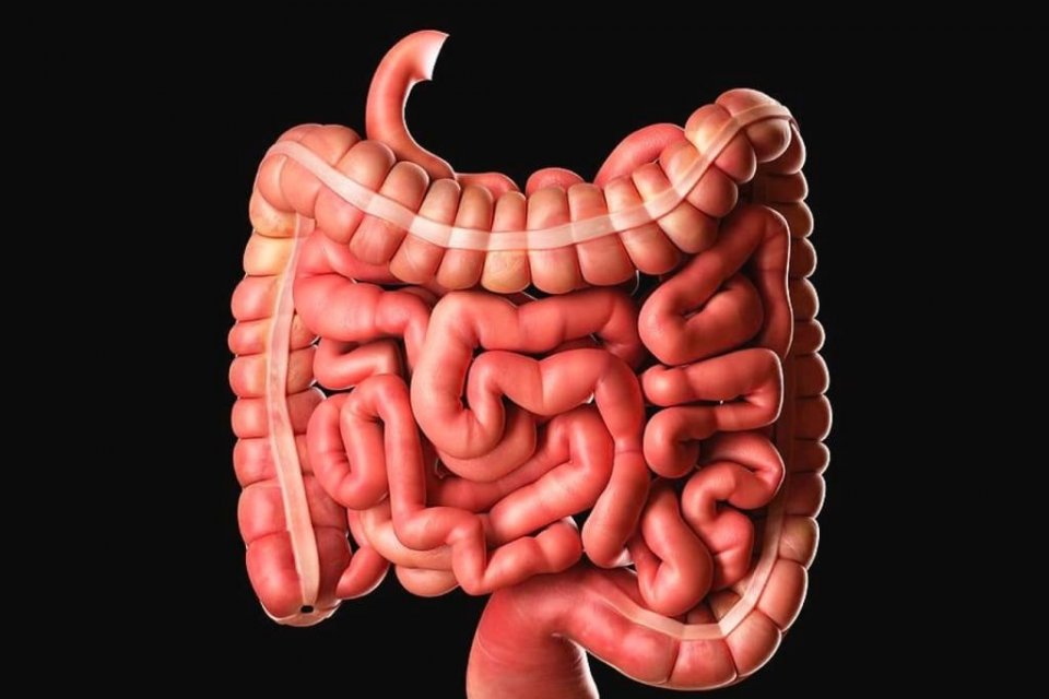 apa itu pembengkakan usus