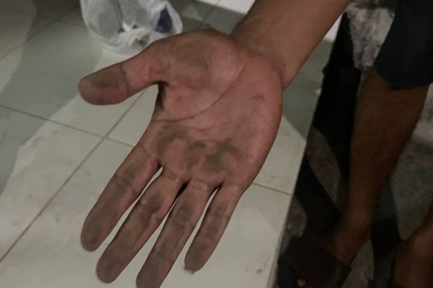 Warga tujukan abu vulkanik dampak erupsi Gunung Anak Krakatau di Pasauran, Kabupaten Serang, Banten, Sabtu malam.